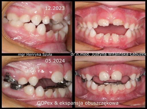 Case report