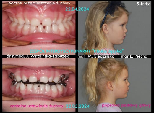 Case report
