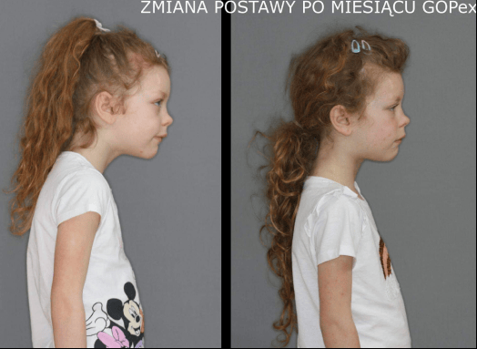 Case report