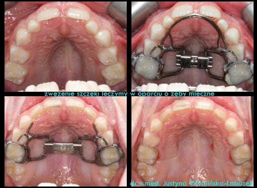 Case report