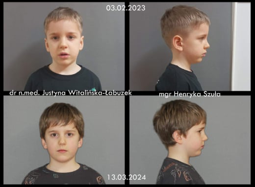 Case report